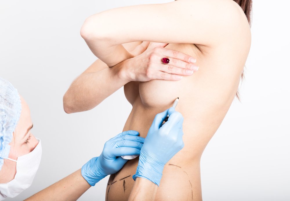 Common Types of Breast Augmentation - Cosmetic Surgeons of Michigan, P.C.