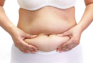 woman holding roll of fat on tummy