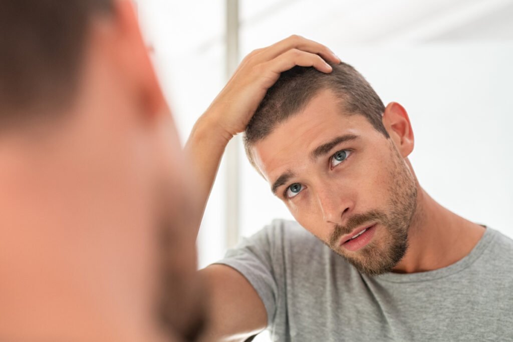 Young man looking at hair in mirror after hair transplant